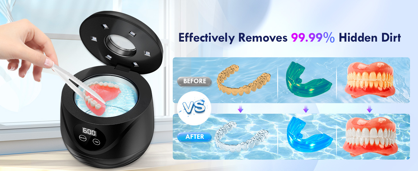 dental appliance cleaner ultrasonic