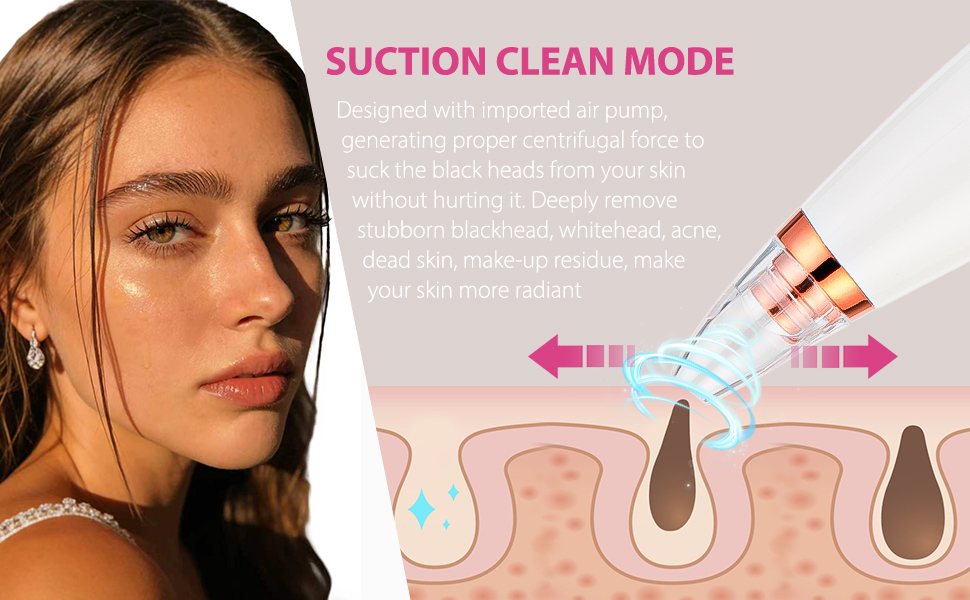 Blackhead remover
