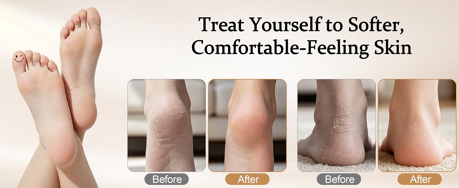Treat Yourself to Softer, Comfortable-Feeling Skin