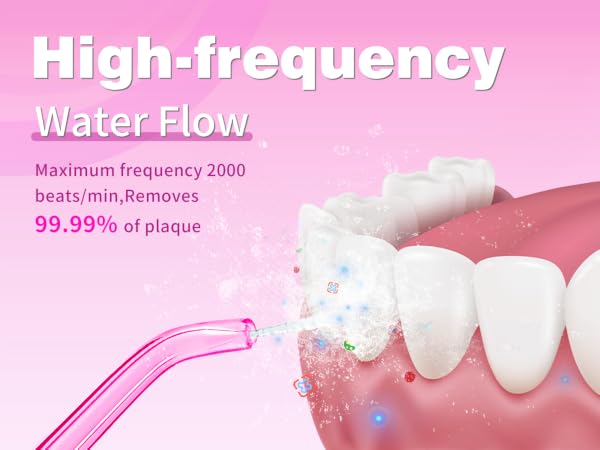 High-frequency Water Flow will remove 99.99% of plaque
