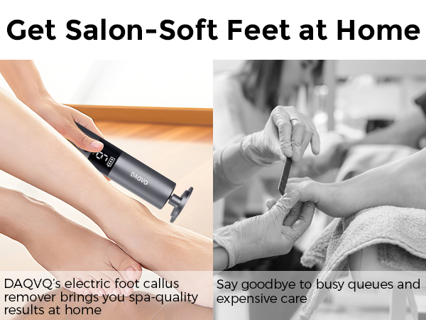 callus remover for feet