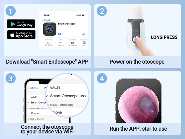 HD Digital Otoscope