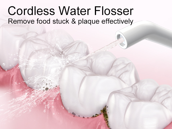 Cordless water flosser