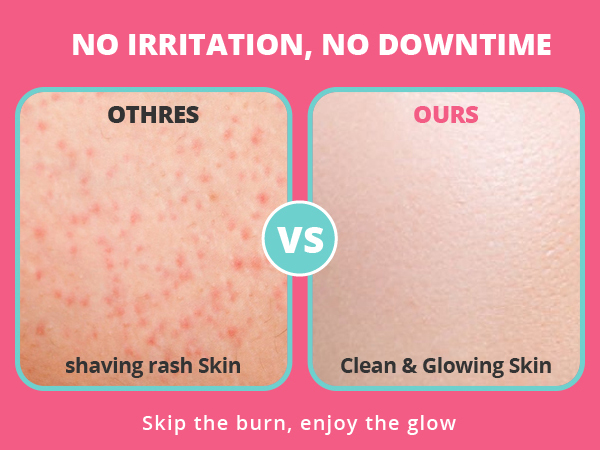 No irritation, no downtime