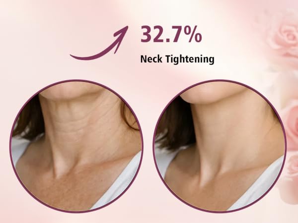 Neck Tightening