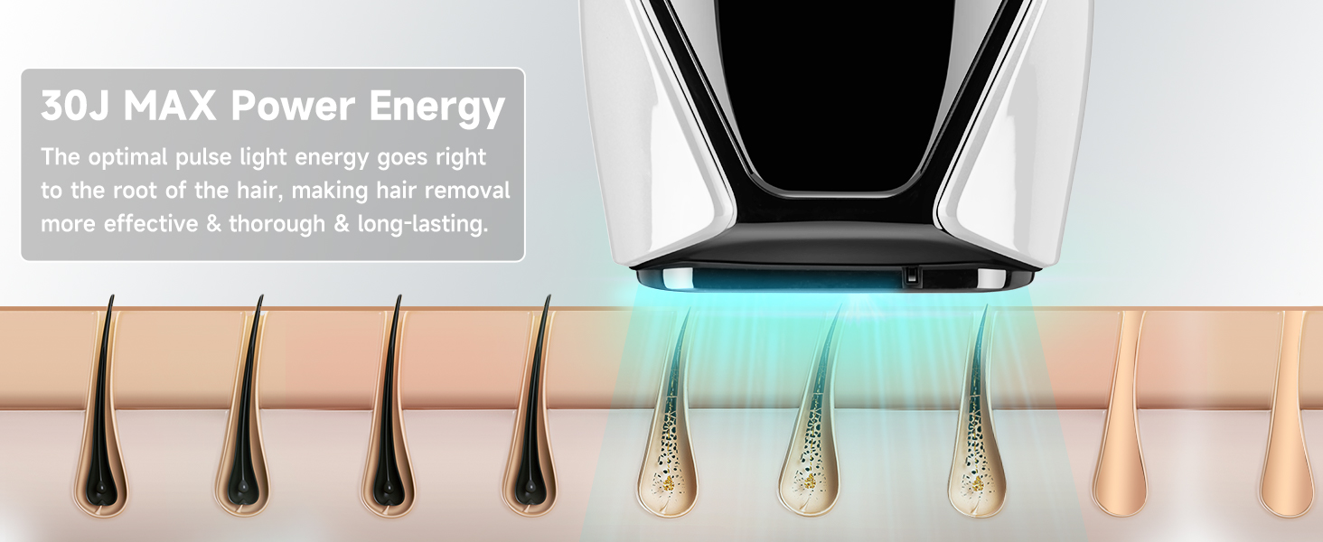 at home laser hair removal