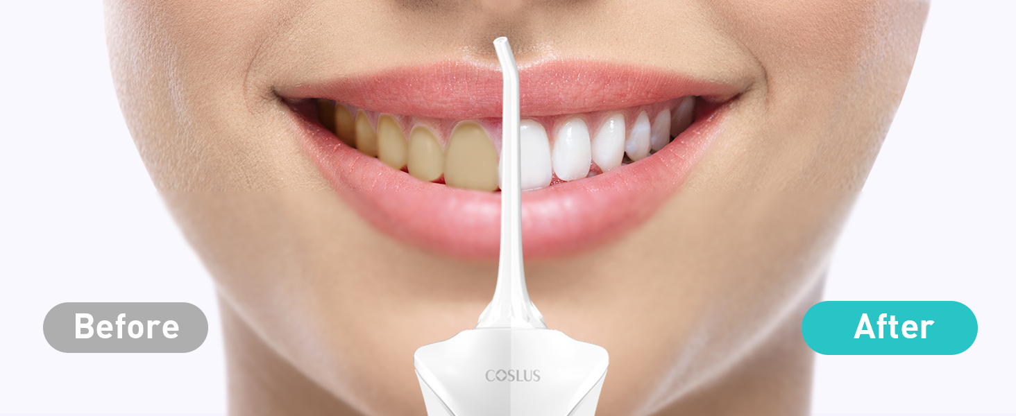 water dental flosser pick teeth cordlss portable Hilo dental con agua, recoge los dientes