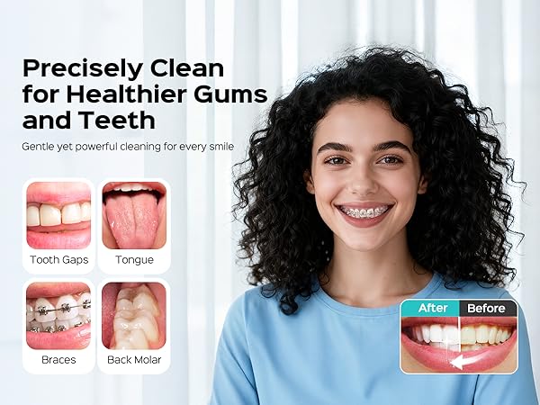 Portable Water Flosser