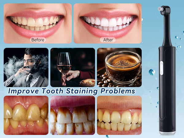 tooth polisher