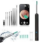 OKUBOX Ear Wax Removal Tool, Ear Cleaner with Camera and Light, Smart Visual Earwax Removal kit W...