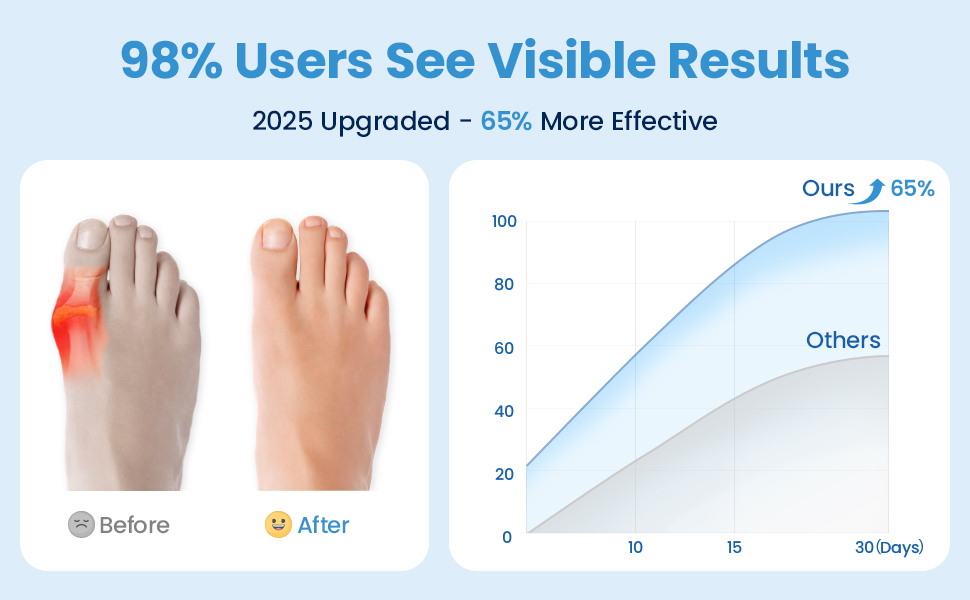 bunion corrector for women big toe