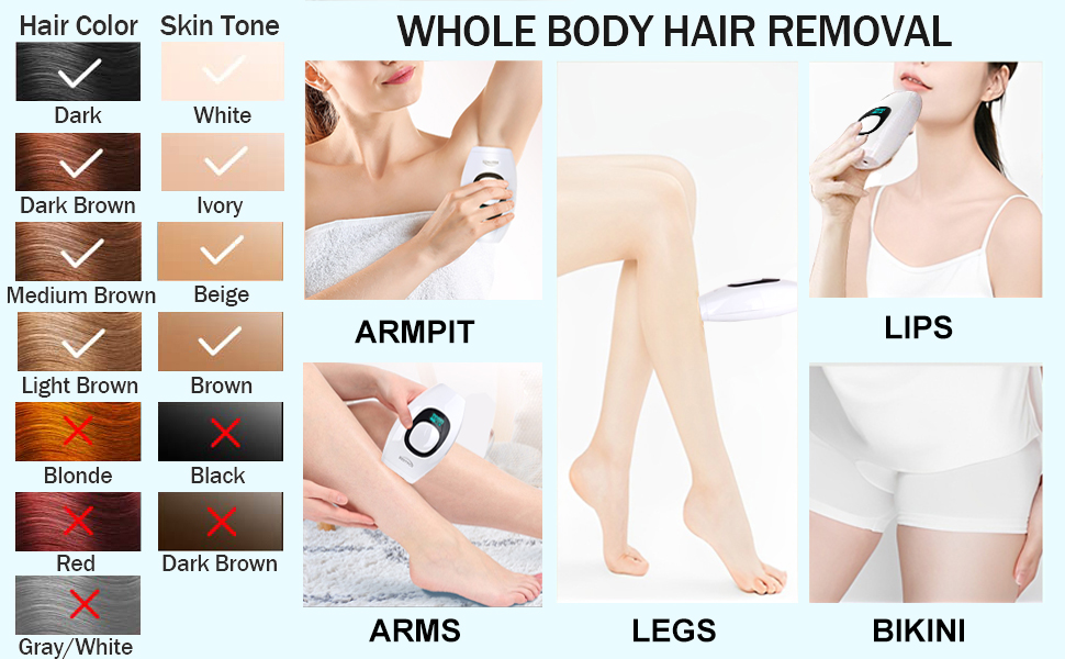 laser hair removal for women