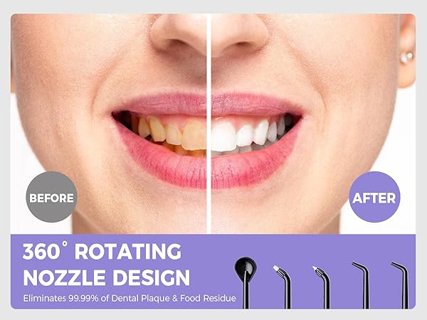 water flossers for teeth