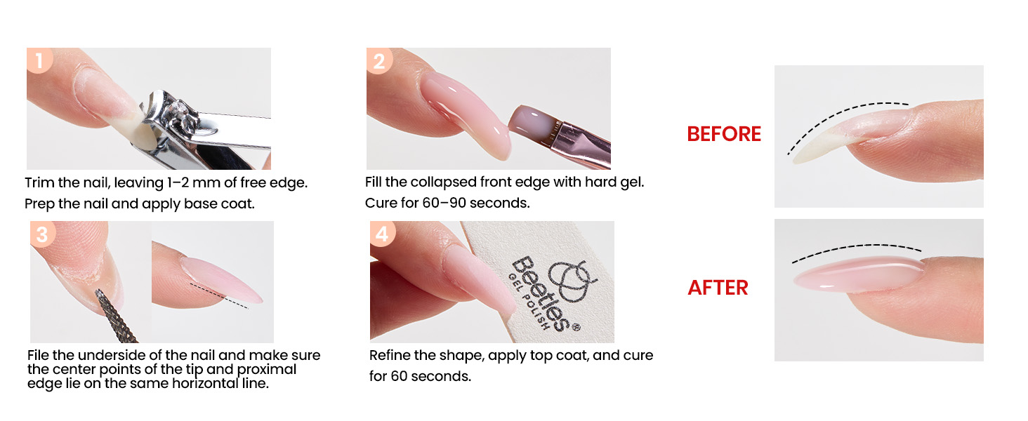 Correct Downward Curving Nails