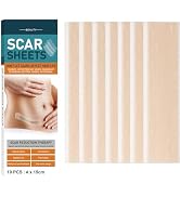 Silicone Scar Sheets(10 Pack),LXIANGN Medical Grade Silicone Strips (1.5" x 6") Professional Scar...