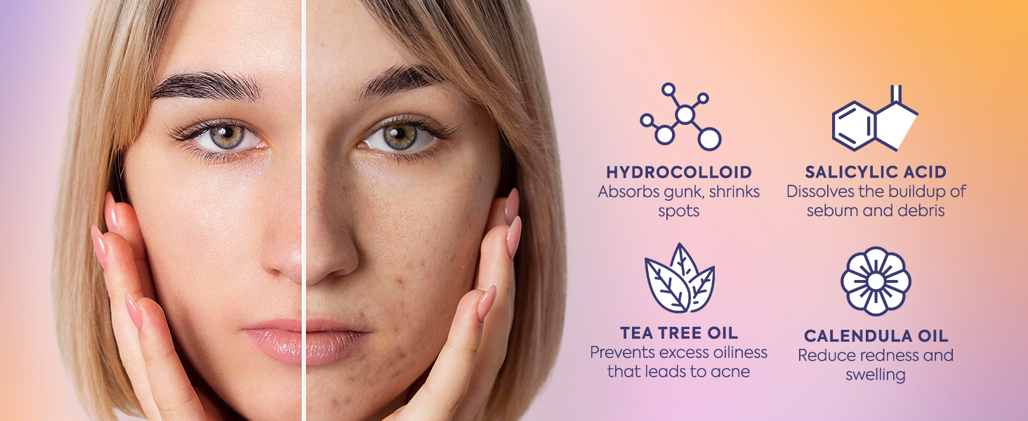 120 Count Circle Pimple Patches