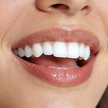Whitening Support