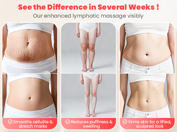 Anti Cellulite Massage Tool