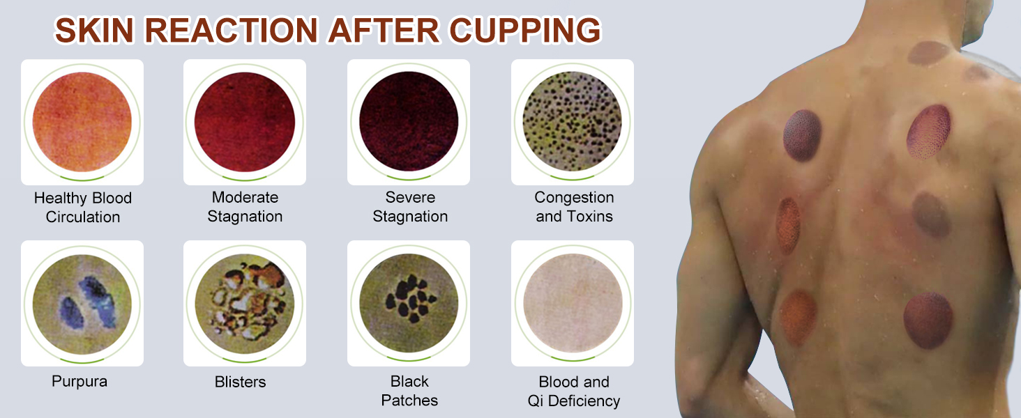 12cups-7