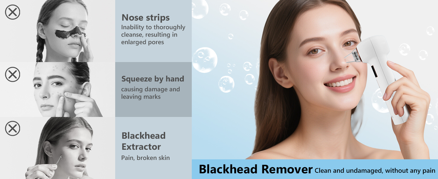 Blackhead Remover