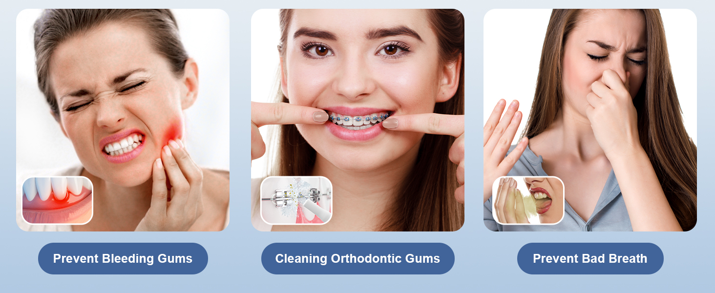 Prevent Bleeding Gums Cleaning Orthodontic Gums Prevent Bad Breath