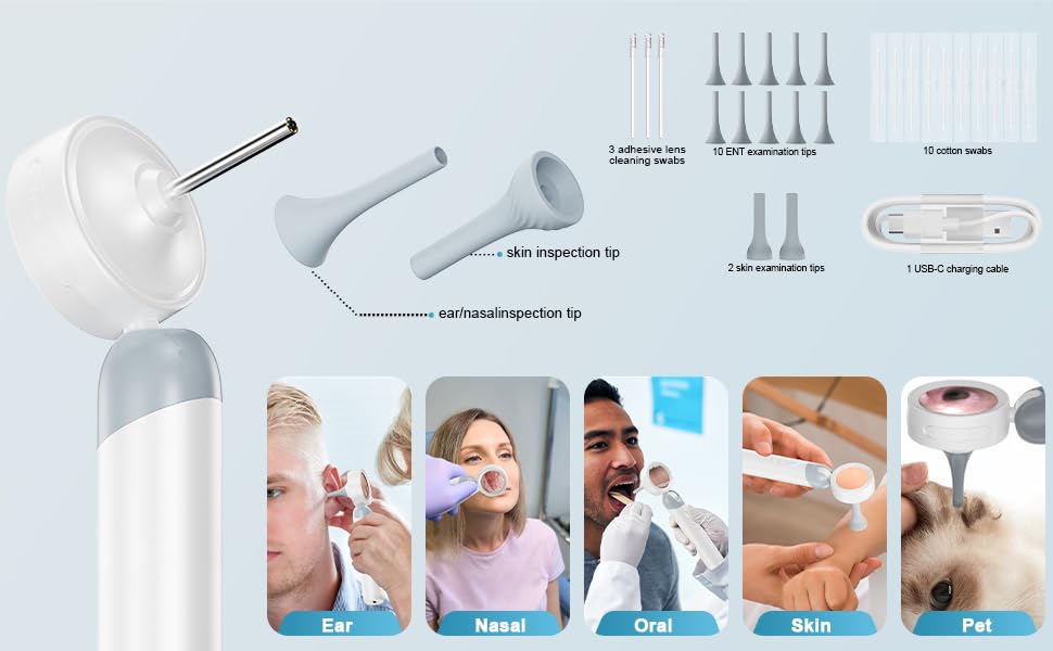 Aspoven Digital Otoscope