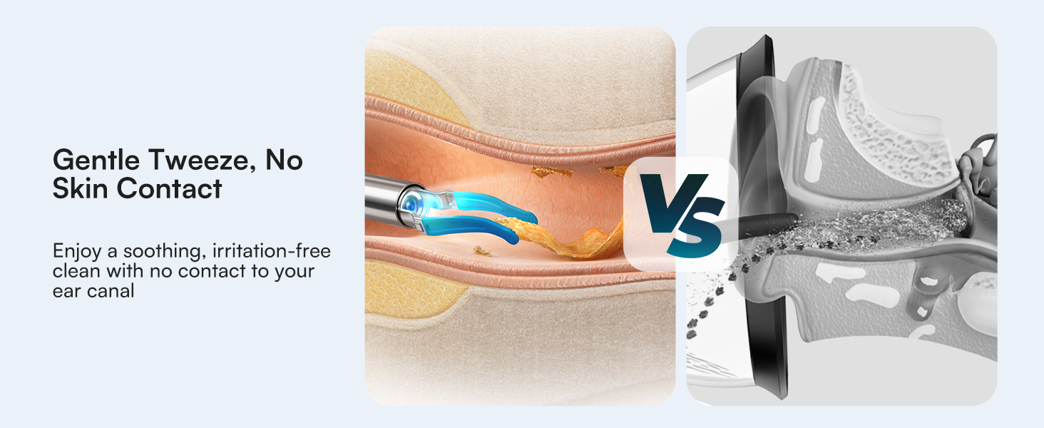 ear wax removal kit with camera