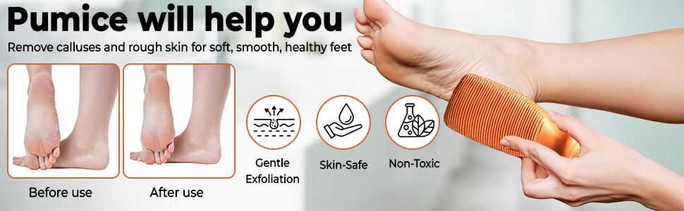 Pumice Stone for Feet