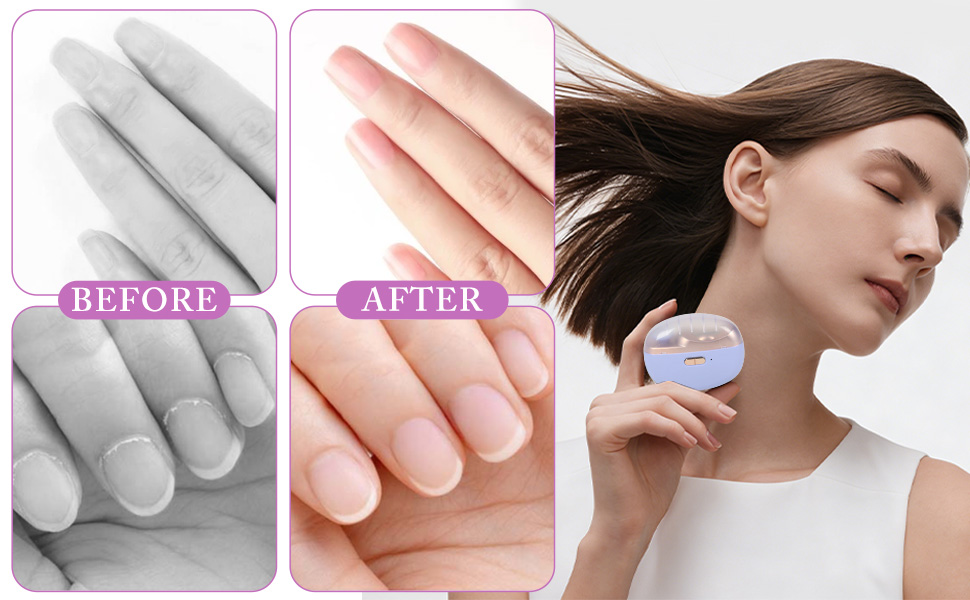 Electric Nail Clipper