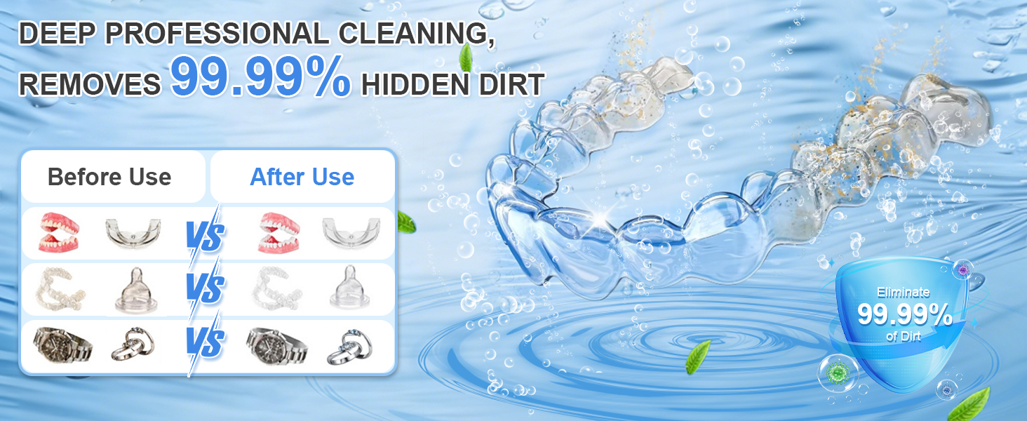 ultrasonic retainer cleaner