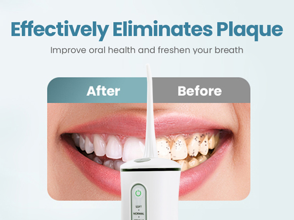 Electric Teeth Cleaner
