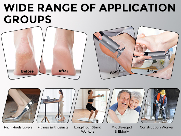 pedicure tools for feet