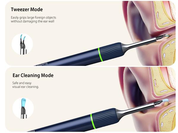 Ear Tweezers &amp; Ear Spoon