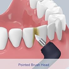 Tooth Polisher