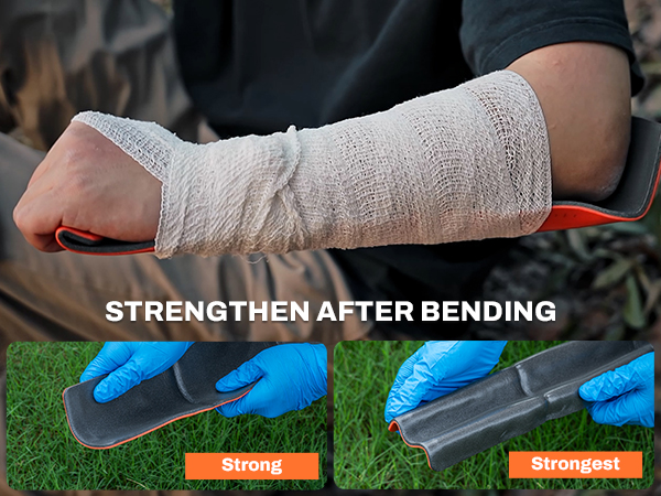 sam splint