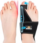 INDEEMAX Bunion Corrector for Women Men Big Toe 2Pack, Orthopedic Bunion Splint for Hallux Valgus...