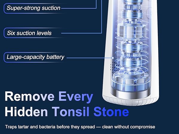 Tonsil Stone Remover Kit