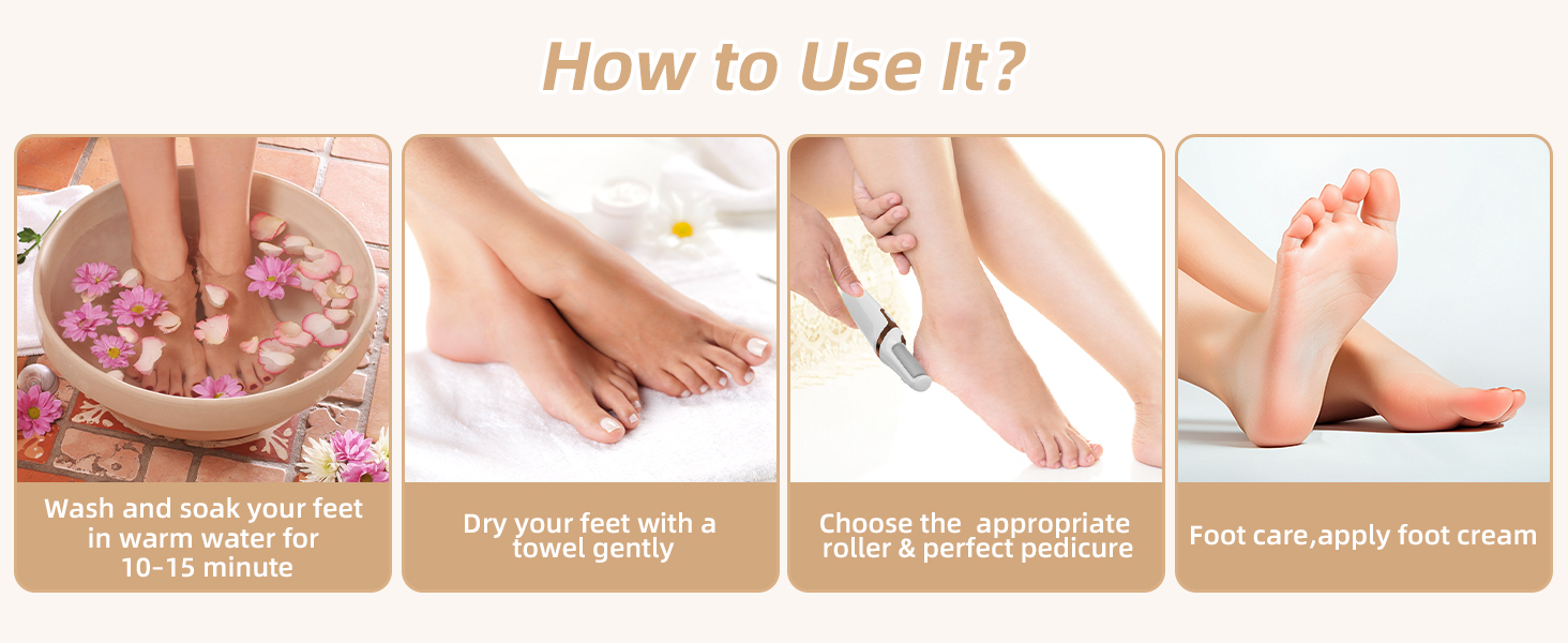 electric callus remover