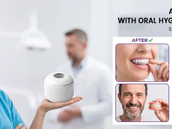 Ultrasonic Retainer Cleaner
