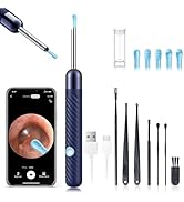 Ear Wax Removal - Earwax Remover Tool with 8 Pcs Ear Set - Ear Canal Cleaner with 1080P Camera - ...