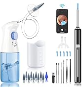 Ear Wax Removal - Ear Cleaner - Ear Camera - Ear Wax Removal Kit - Ear Wax Removal Tool Camera - ...