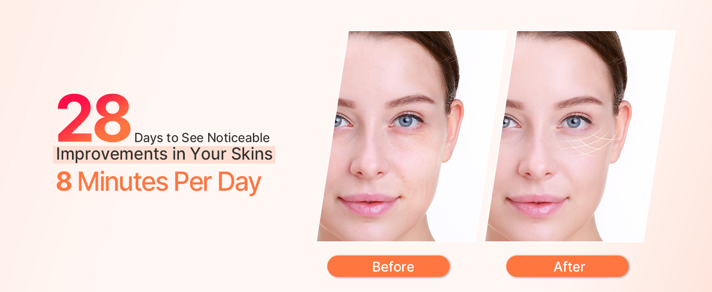 Hot &amp;amp; Cold Facial Massager