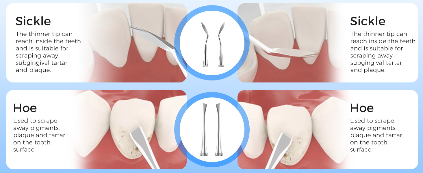 electric teeth cleaner