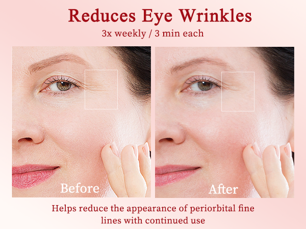RF Skin Tightening Face Machine