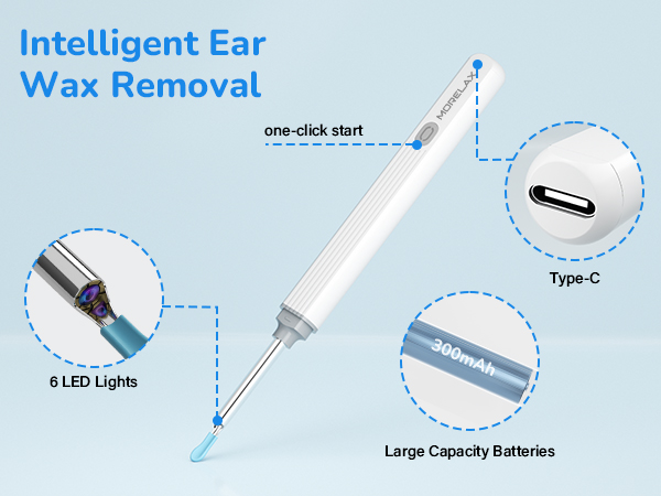 earwax removal