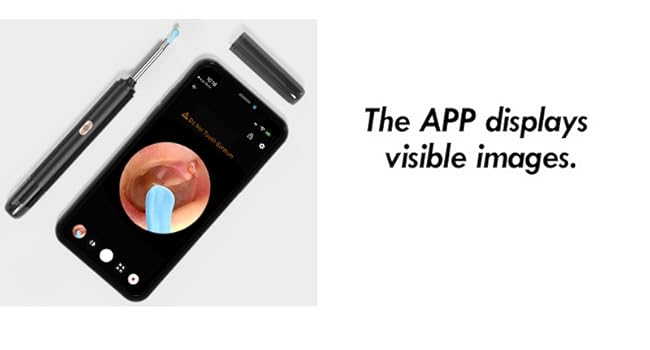 ear wax removal tool camera