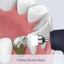 Tooth Polisher