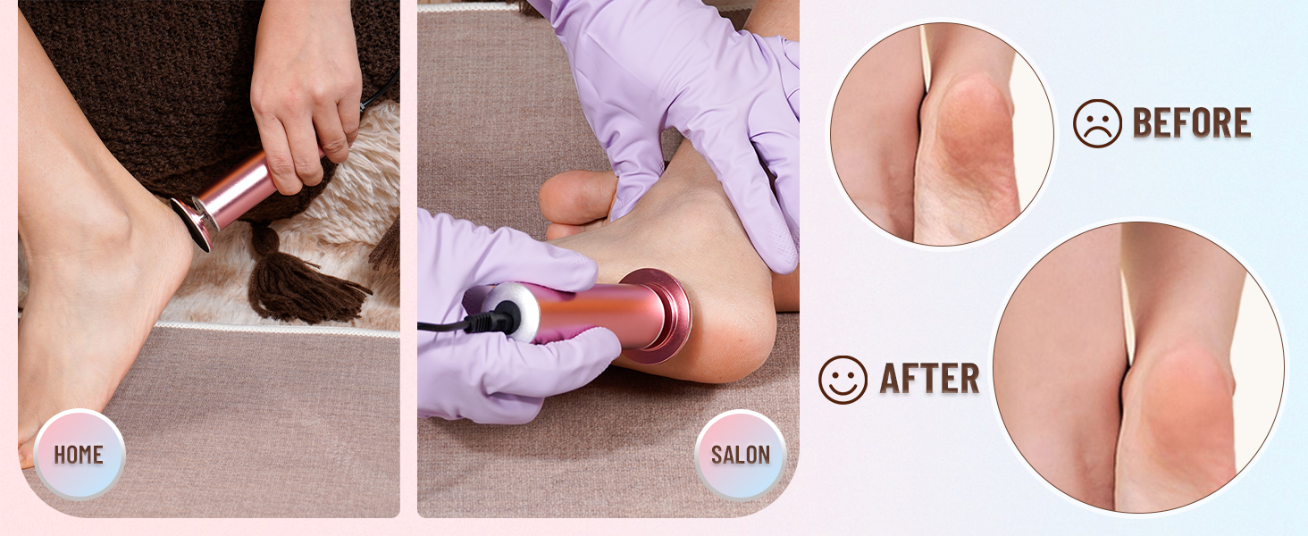 electric foot file