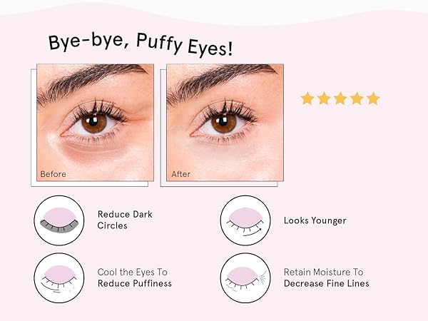 Say goodbye to puffy eyes! grace and stella under eye mask with before and after model comparison