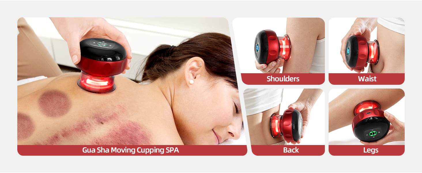 cupping set cupping therapy set cupping kit for massage therapy